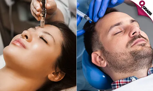 PRP & Microneedling Session!